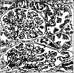 Argyria: figure 1 from the 1928–1936 encyclopedia article