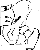 LEG: figure 1 from the 1928–1936 encyclopedia article