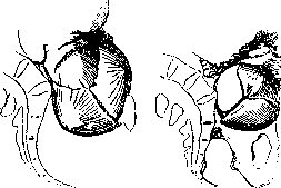 Pelvis: figure 31 from the 1928–1936 encyclopedia article