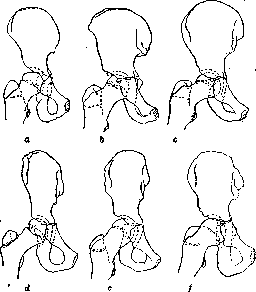 Pelvis: figure 3 from the 1928–1936 encyclopedia article