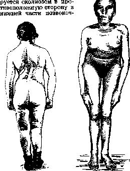 Pelvis: figure 22 from the 1928–1936 encyclopedia article