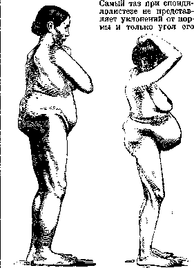 Pelvis: figure 21 from the 1928–1936 encyclopedia article