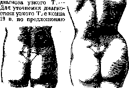 Pelvis: figure 25 from the 1928–1936 encyclopedia article