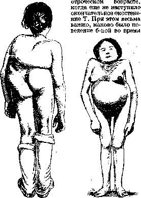 Pelvis: figure 23 from the 1928–1936 encyclopedia article