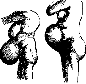 Pelvis: figure 27 from the 1928–1936 encyclopedia article
