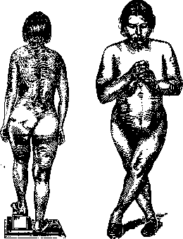 Pelvis: figure 24 from the 1928–1936 encyclopedia article