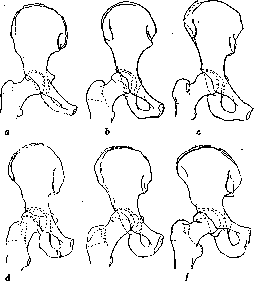 Pelvis: figure 4 from the 1928–1936 encyclopedia article