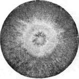 Dermatophytes: figure 8 from the 1928–1936 encyclopedia article