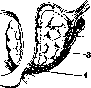 Prostate Gland: figure 11 from the 1928–1936 encyclopedia article
