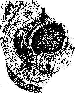 Prostate Gland: figure 13 from the 1928–1936 encyclopedia article