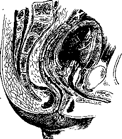 Prostate Gland: figure 12 from the 1928–1936 encyclopedia article