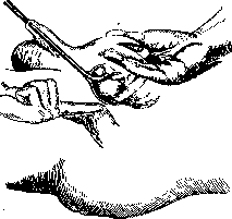 Prostate Gland: figure 15 from the 1928–1936 encyclopedia article
