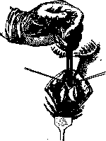 Prostate Gland: figure 19 from the 1928–1936 encyclopedia article