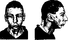 Imbecility: figure 1 from the 1928–1936 encyclopedia article
