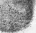 Inguinal Region: figure 5 from the 1928–1936 encyclopedia article