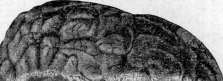 Inguinal Region: figure 2 from the 1928–1936 encyclopedia article