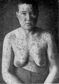 Inguinal Region: figure 1 from the 1928–1936 encyclopedia article
