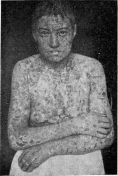 Inguinal Region: figure 4 from the 1928–1936 encyclopedia article