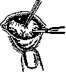 Deutschmann's Operation: figure 1 from the 1928–1936 encyclopedia article