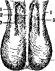 Scrotum: figure 1 from the 1928–1936 encyclopedia article