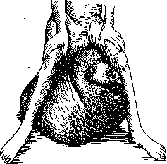 Scrotum: figure 3 from the 1928–1936 encyclopedia article