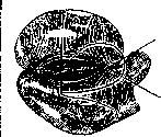 Gastroenterostomy: figure 2 from the 1928–1936 encyclopedia article