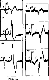 Extrapyramidal System: figure 3 from the 1928–1936 encyclopedia article