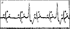 Extrapyramidal System: figure 4 from the 1928–1936 encyclopedia article