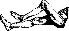 Gonitis: figure 5 from the 1928–1936 encyclopedia article