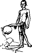 Gonitis: figure 6 from the 1928–1936 encyclopedia article