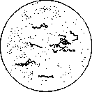 Water Fever: figure 4 from the 1928–1936 encyclopedia article