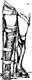 Hip Joint: figure 15 from the 1928–1936 encyclopedia article