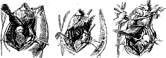 Hip Joint: figure 41 from the 1928–1936 encyclopedia article