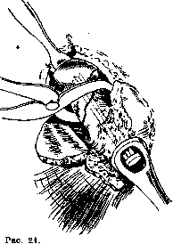 Hip Joint: figure 20 from the 1928–1936 encyclopedia article