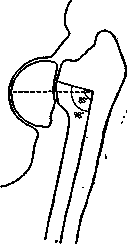 Hip Joint: figure 8 from the 1928–1936 encyclopedia article