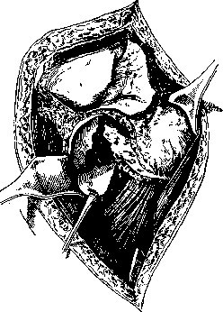 Hip Joint: figure 18 from the 1928–1936 encyclopedia article