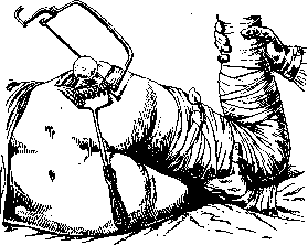 Hip Joint: figure 36 from the 1928–1936 encyclopedia article