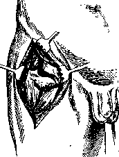 Hip Joint: figure 47 from the 1928–1936 encyclopedia article