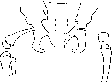 Hip Joint: figure 2 from the 1928–1936 encyclopedia article
