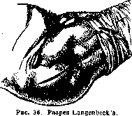 Hip Joint: figure 33 from the 1928–1936 encyclopedia article