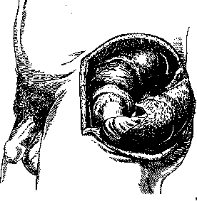 Hip Joint: figure 39 from the 1928–1936 encyclopedia article
