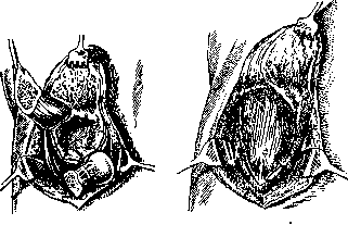 Hip Joint: figure 42 from the 1928–1936 encyclopedia article