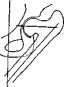 Hip Joint: figure 4 from the 1928–1936 encyclopedia article