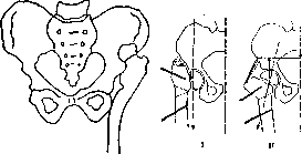 Hip Joint: figure 29 from the 1928–1936 encyclopedia article
