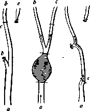 Common Carotid Artery: figure 3 from the 1928–1936 encyclopedia article