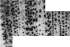 Myelitis: figure 5 from the 1928–1936 encyclopedia article