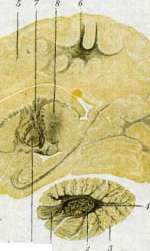Myelitis: figure 2 from the 1928–1936 encyclopedia article