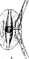 Trachelotomy: figure 3 from the 1928–1936 encyclopedia article