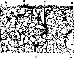 Anthracosis: figure 1 from the 1928–1936 encyclopedia article