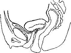 Vaginofixation: figure 1 from the 1928–1936 encyclopedia article